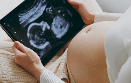 Femme enceinte tenant une échographie entre les mains